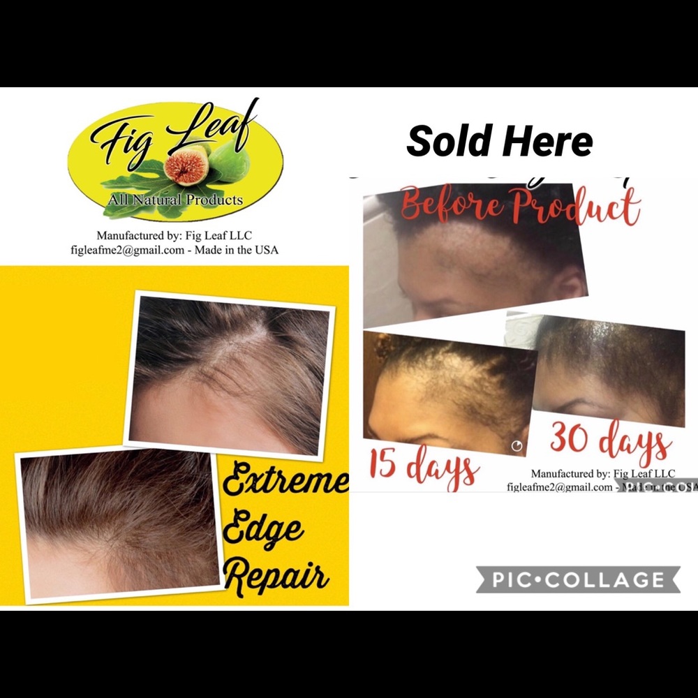 Don’t be embarrassed anymore with thinning hair..